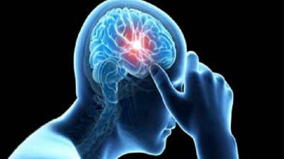 ব্রেন স্ট্রোক আসলে কী? কাদের বেশি হয়?