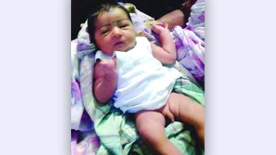 প্রসূতির অস্ত্রোপচারের পর ‘ধাতব বস্তু রেখে’ সেলাই