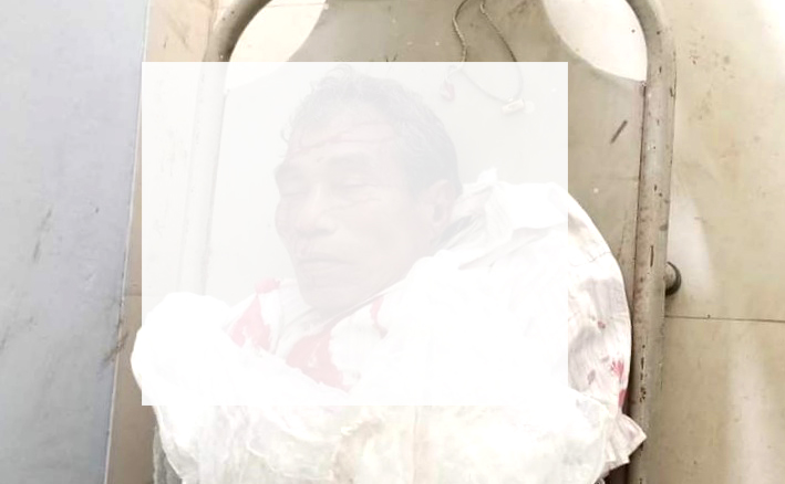 মানিকছড়িতে ইজিবাইকের ধাক্কায় পথচারী নিহত