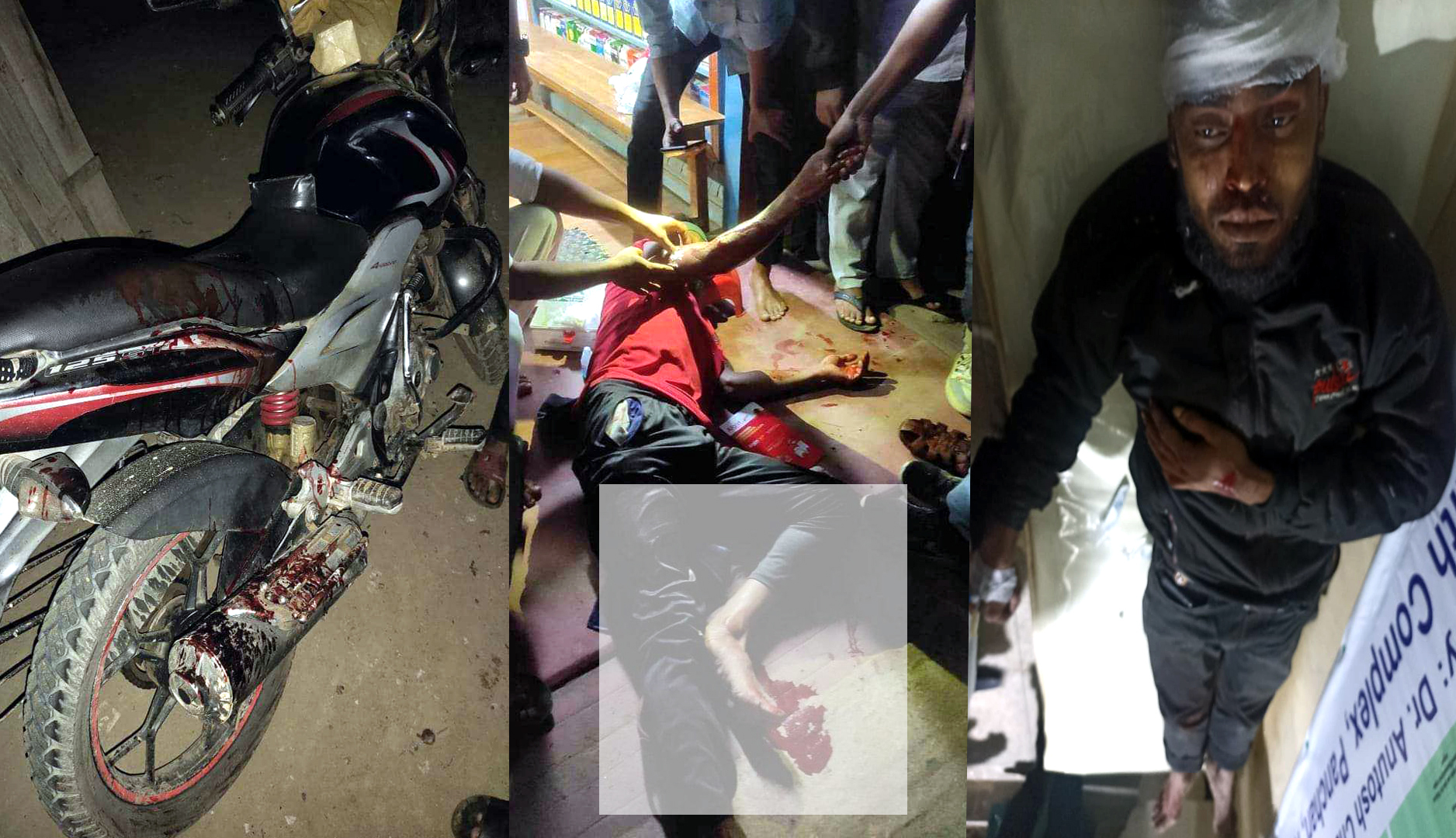 ব্রাশফায়ারে দুই মোটরসাইকেল আরোহী গুরুত্বর