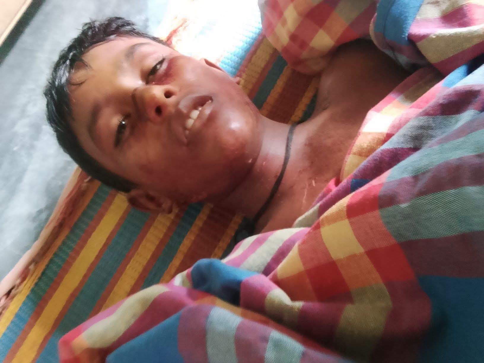জামগাছ থে‌কে পড়ে স্কুল ছা‌ত্রের মৃত্যু